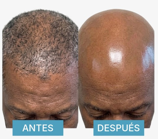Bald Head Razor